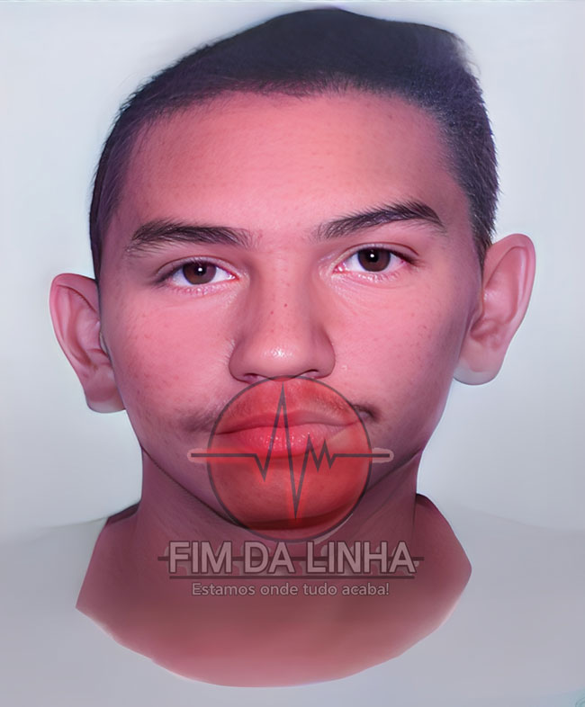 Jovem de 21 anos morre após grave acidente envolvendo moto e cavalo em Mossoró