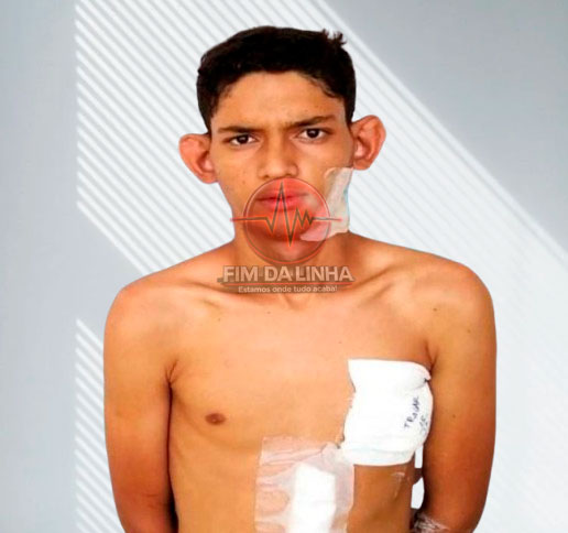 suspeito morre ao reagir abordagem da PM e trocar tiros com policiais do Bope e Rocam em Caraúbas