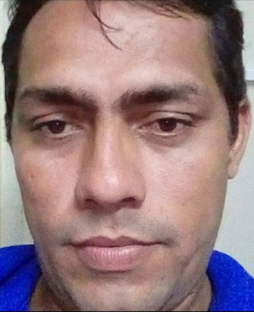 Colisão entre motocicletas deixa um morto e outro gravemente ferido na BR-110 em Mossoró